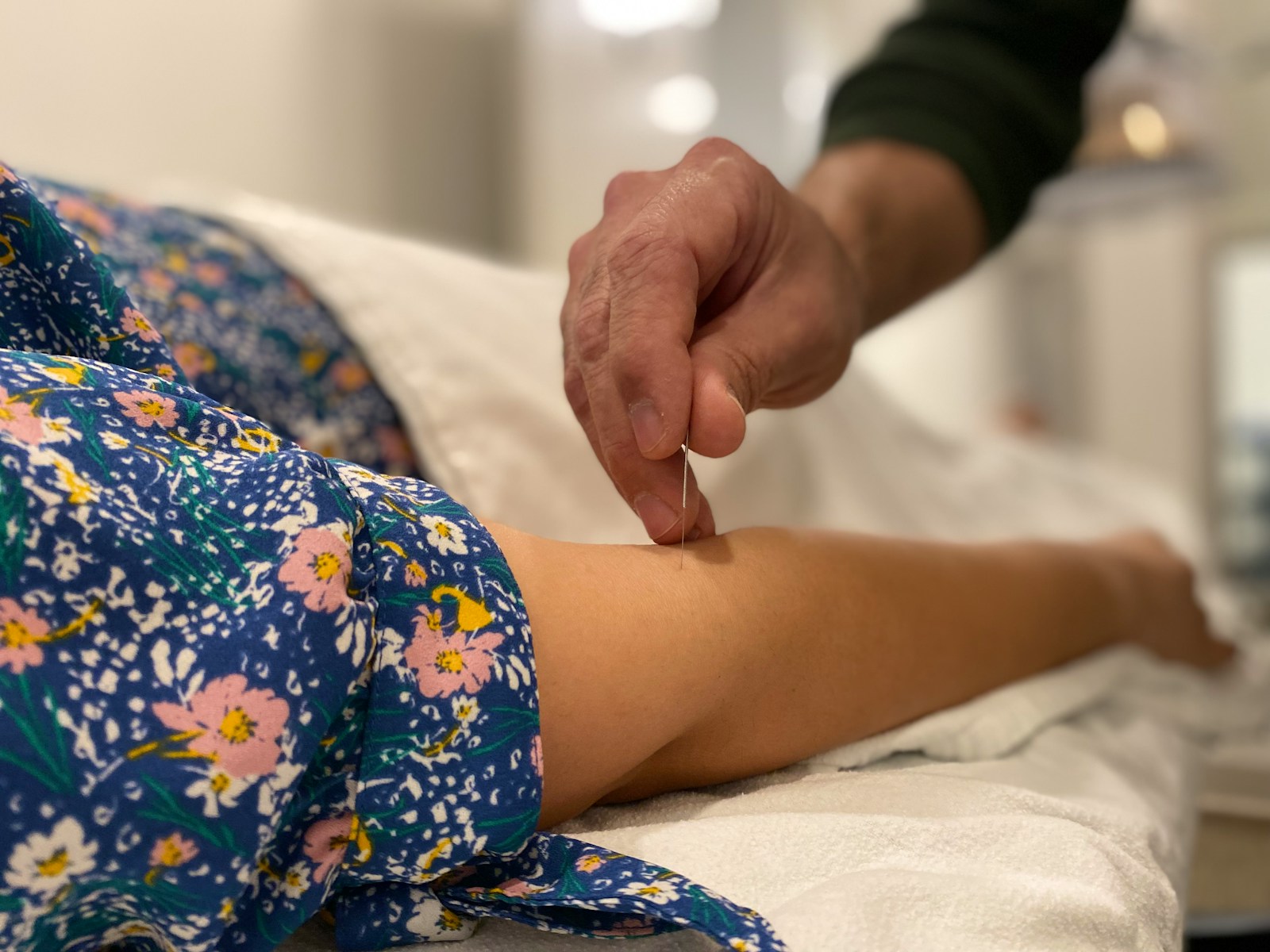 Acupuncture treatment
